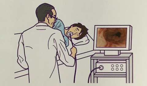 内視鏡（胃カメラ）検査
